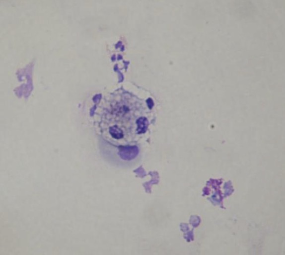 <p>Vaginal cytology → will see trophoblast cells</p>