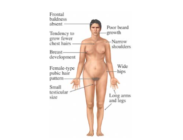 <ul><li><p>Genotype: XXY</p></li><li><p>1 in 1000 male births</p></li></ul><p></p>