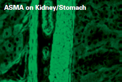 <p>Positive: Fluorescence in kidney and stomach muscular layers</p><p>Negative: No Fluorescence</p>