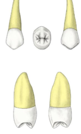 <p>Which tooth?</p>