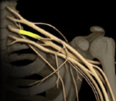 <p>Identify the structure</p>