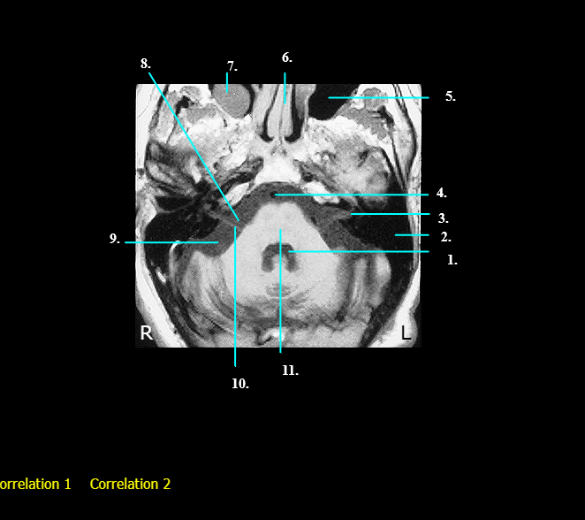 <p>Label 1 - 4</p>