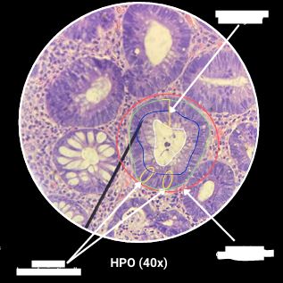 <p>What are the arrows pointing?</p>