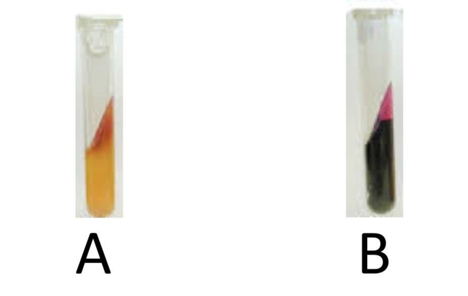 <p>Hydrogen Sulfide Production Test</p><p>a) Medium?</p><p>b) Substrate?</p><p>c) Enzyme?</p><p>d) Indicator/Reagent?</p><p>e) End Product?</p>