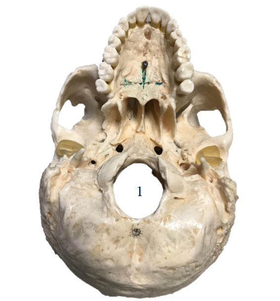 <p>Name the term.</p>