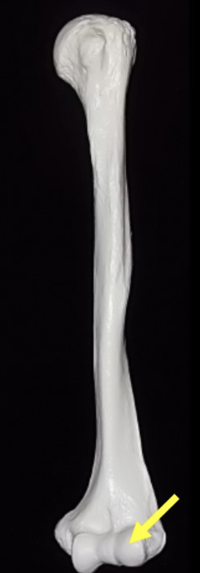 <p>Capitulum (humerus distal end)</p>