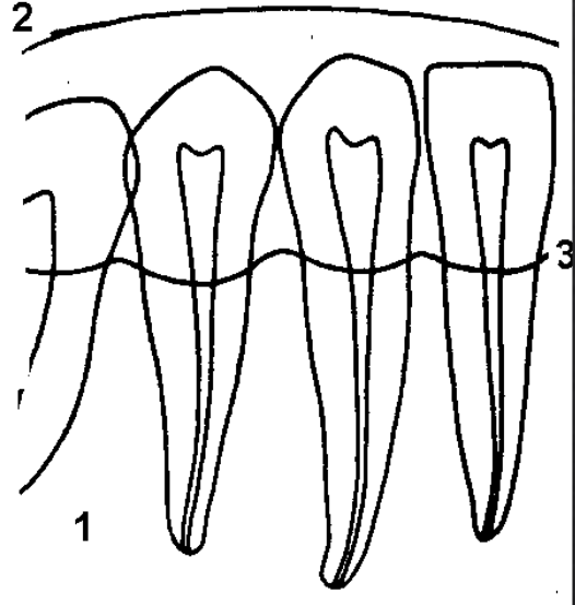 <p>Hvad viser 3?</p>