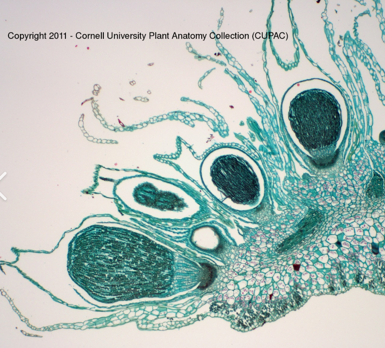 <p>diploid, surrounded by enlarged archegonia. depends on archegoniophore for nutrients and water</p>