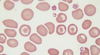 <p>codocyte (target cell)</p>