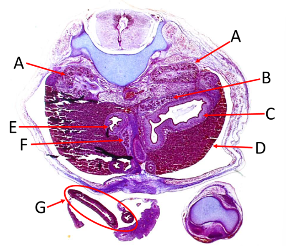 <p>Label A, B, C, D, E, F and G</p>