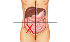 <p>cecum, appendix, right ovary and tube, right ureter, right spermatic cord</p>
