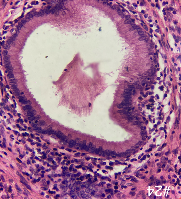 <p>Diagnose</p>