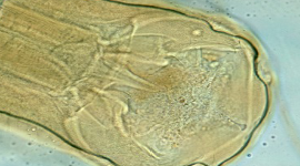 <p>Identify the causative agent</p>