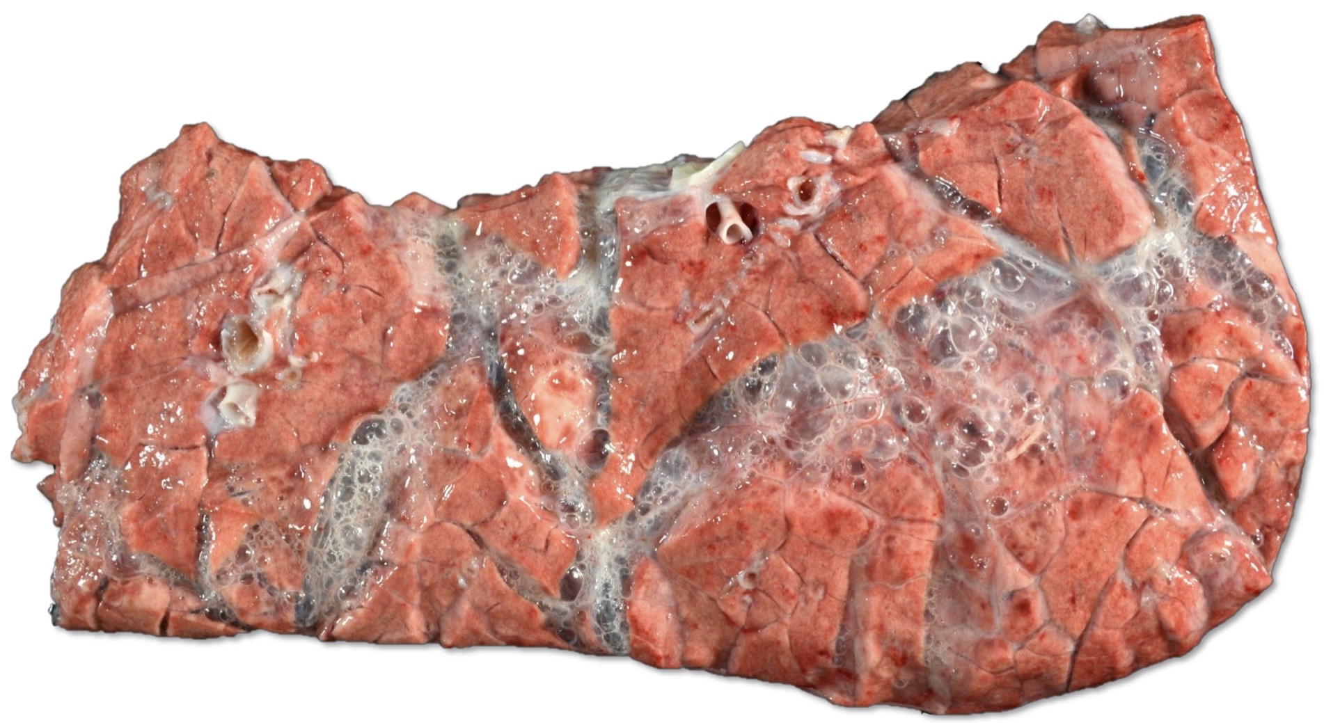 <p>Patogenia </p>