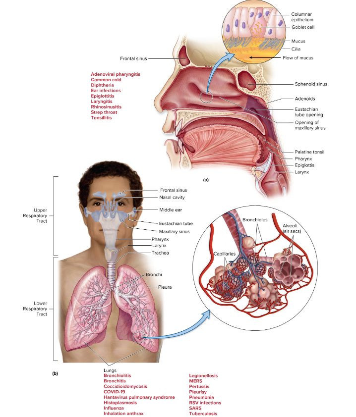 <p><mark data-color="blue" style="background-color: blue; color: inherit;">½ ways respiratory infections are divided by</mark></p><p><u>[__] » <mark data-color="yellow" style="background-color: yellow; color: inherit;">refers to the head and neck region, diseases here are:</mark></u></p><ul><li><p>very common</p></li><li><p><mark data-color="yellow" style="background-color: yellow; color: inherit;">uncomfortable but not life-threatening</mark></p></li><li><p><mark data-color="yellow" style="background-color: yellow; color: inherit;">contains normal microbiota in nose and throat</mark></p><ul><li><p><em><mark data-color="purple" style="background-color: purple; color: inherit;">Streptococci</mark></em> in throat</p></li><li><p><em><mark data-color="purple" style="background-color: purple; color: inherit;">S. aureus</mark></em> in nose (~30% of healthy individuals)</p></li></ul></li></ul><p></p><p><u>Sterile sites:</u></p><ul><li><p>conjunctiva (eye)</p></li><li><p>sinuses</p></li><li><p>tear ducts</p></li><li><p>middle ear</p></li></ul><p></p>