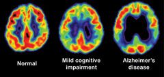<p>makes 3D images of tissue function instead of anatomy by using an injection of a radiolabeled substance that is absorbed by more active tissues</p><p>- can be combined with CT or MRI</p><p>- diagnose cancer, active brain areas</p>