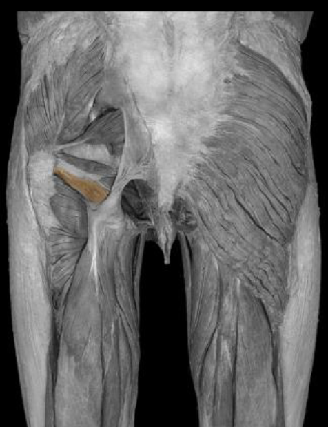 <p>function of gemellus inferior</p>
