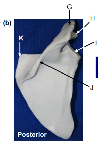 <p>What bone is this? What view of the bone is this?</p>