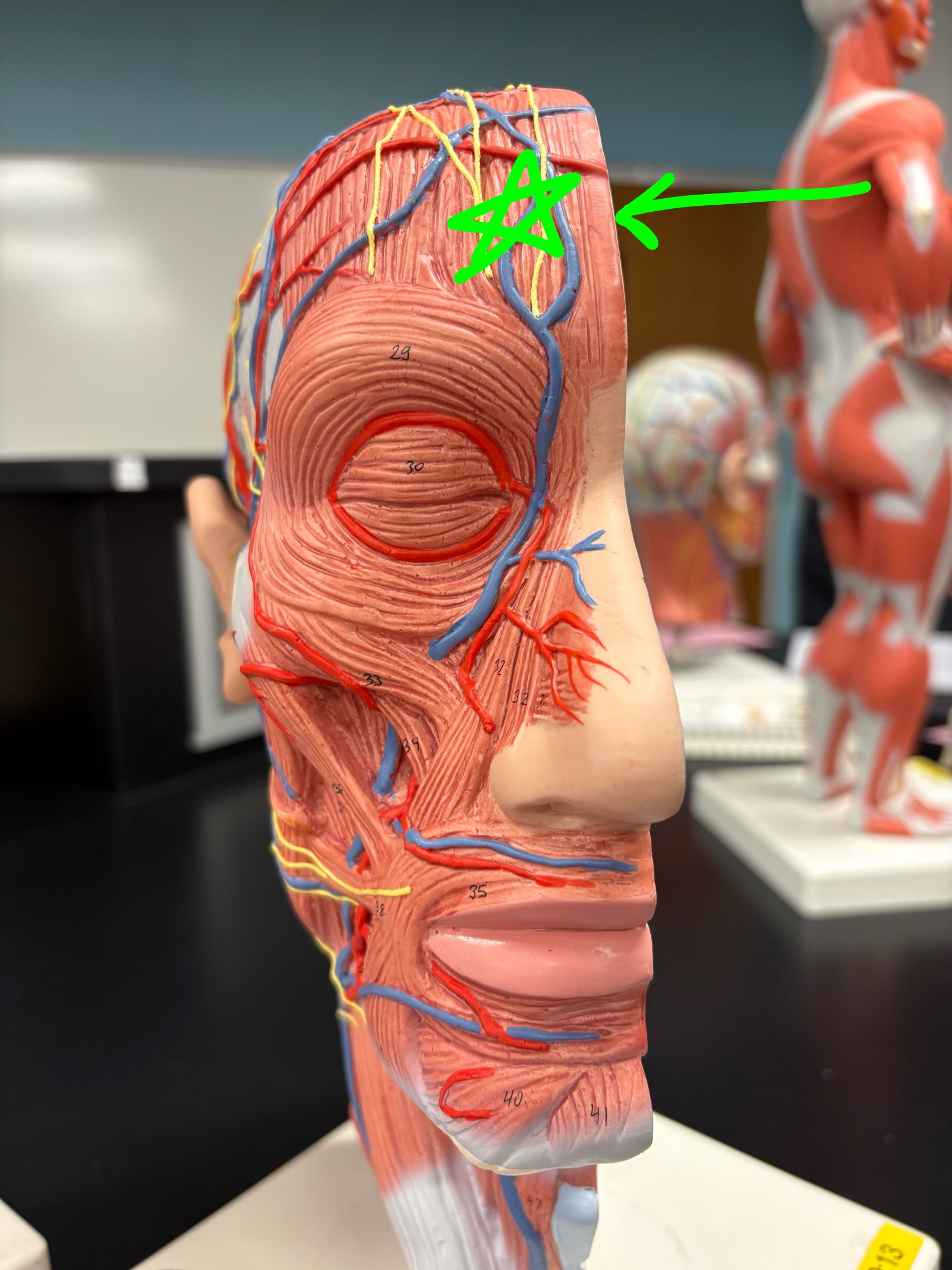 <p>Name the muscle.</p>