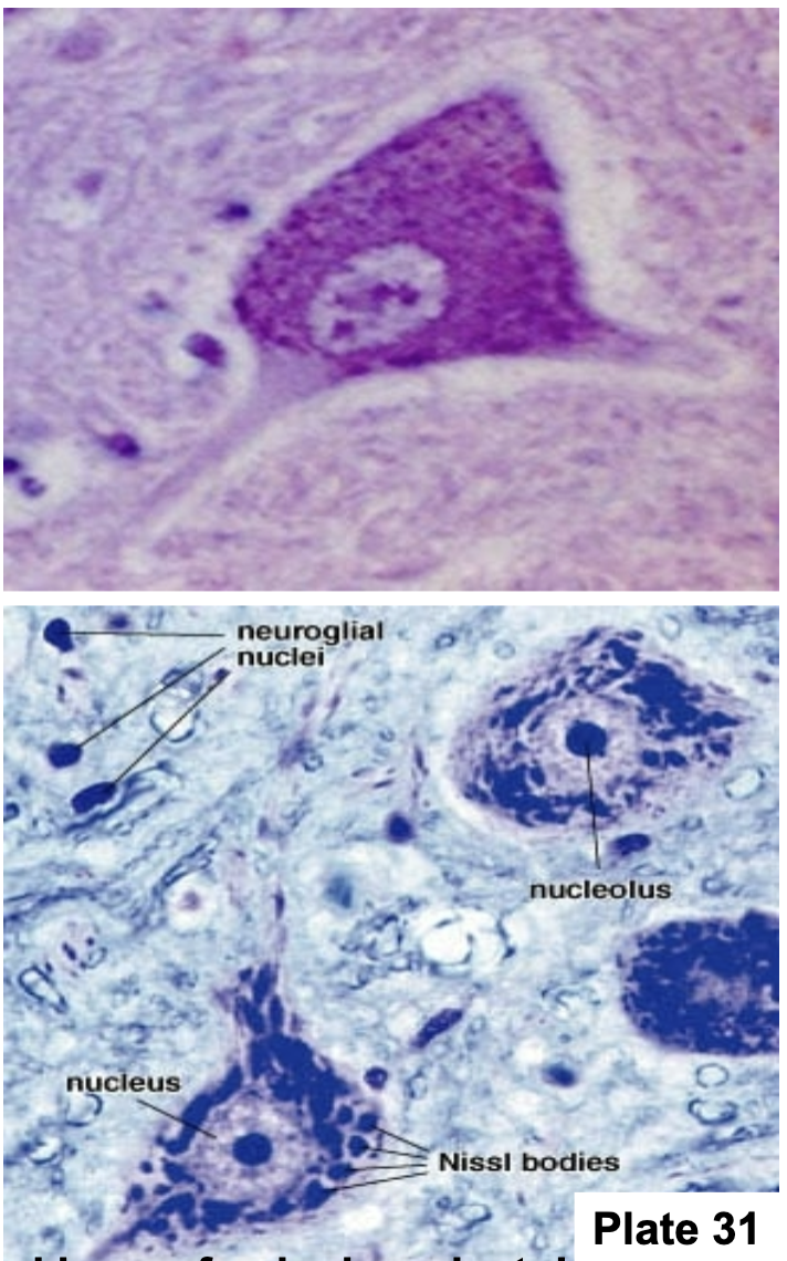<p>multipolar</p>