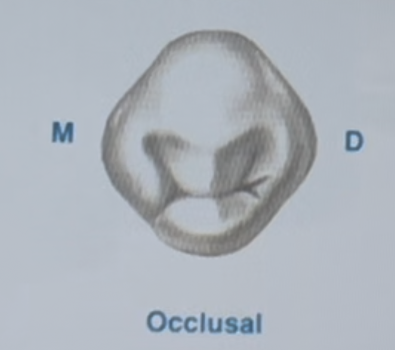 <p>In the diagram of the mandibular first premolar the smaller cusp is the ___ cusp: B, L, DL, none of the above</p>