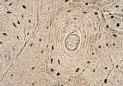 <ol><li><p>Sickle Cell Anemia</p></li><li><p>Atherosclerosis</p></li><li><p>Adenocarcinoma of Kidney</p></li><li><p>Osteogenic Sarcoma of Bone</p></li><li><p>Tattoo in Human Skin</p></li><li><p>Neurilemmoma</p></li><li><p>Anthracosis of the Lung</p></li><li><p>Basal Cell Carcinoma</p></li><li><p>Lung</p></li><li><p>Skeletal</p></li><li><p>Kidney</p></li><li><p>Neuron</p></li><li><p>Skin</p></li><li><p>Blood</p></li><li><p>Bone</p></li><li><p>Aorta</p></li></ol><p></p>