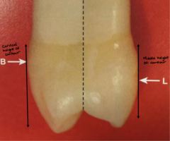 <p>What is the facial height of contour for all premolars?</p>
