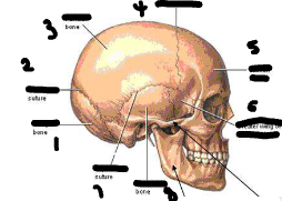 <p>Lable this image</p>