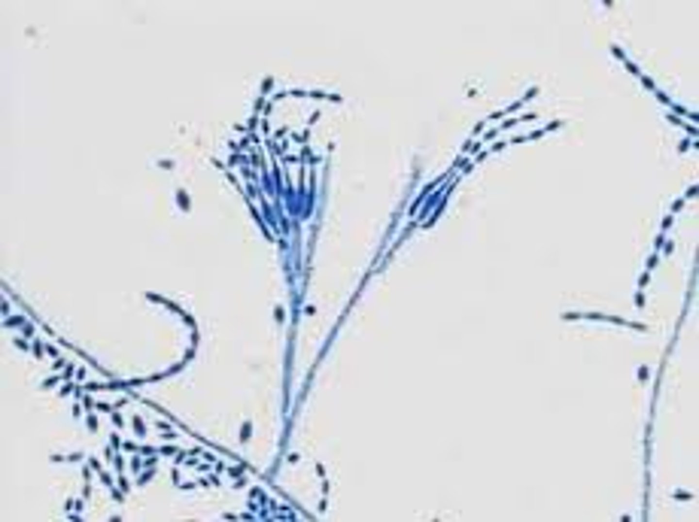 <p>Long chains of conidia</p><p>Conidiophores are wispy</p>