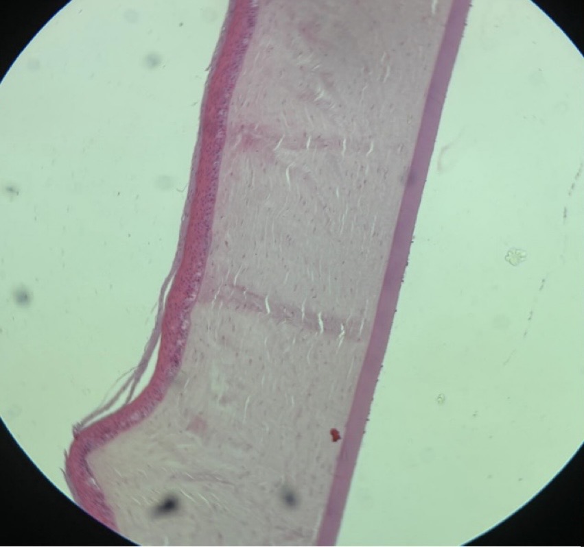 <p>Anterior portion of the eye characterized by Bowman's Membrane and a smooth membrane (descemet).</p>