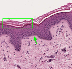 <p>The formation of a protective, superficial layer comprised of cells filled with keratin</p>