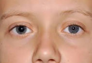 <p><strong><mark data-color="#d6b881" style="background-color: rgb(214, 184, 129); color: inherit;">ADIES PUPIL</mark></strong></p>