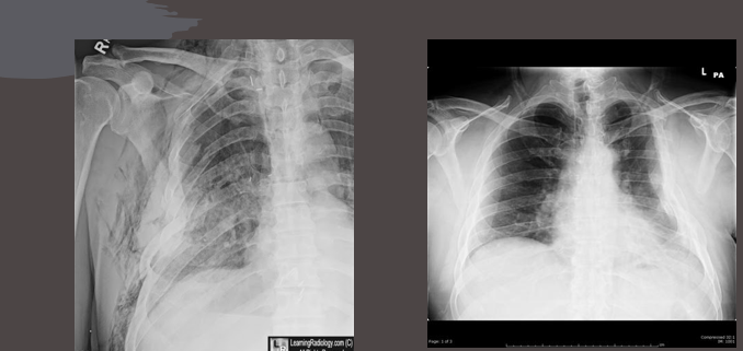 <p>what pathology is this?</p>