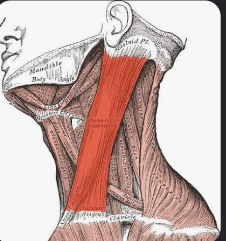 <p>Actions- Flexes neck, laterally flexes neck to the same side, rotates head to the opposite side.</p><p>Functional Groups-</p><p>Synergists- Scalenes, splenius capitis, splenius cervicis.</p><p>Antagonists- Splenius capitis, splenius cervicis, upper trapezius.</p>