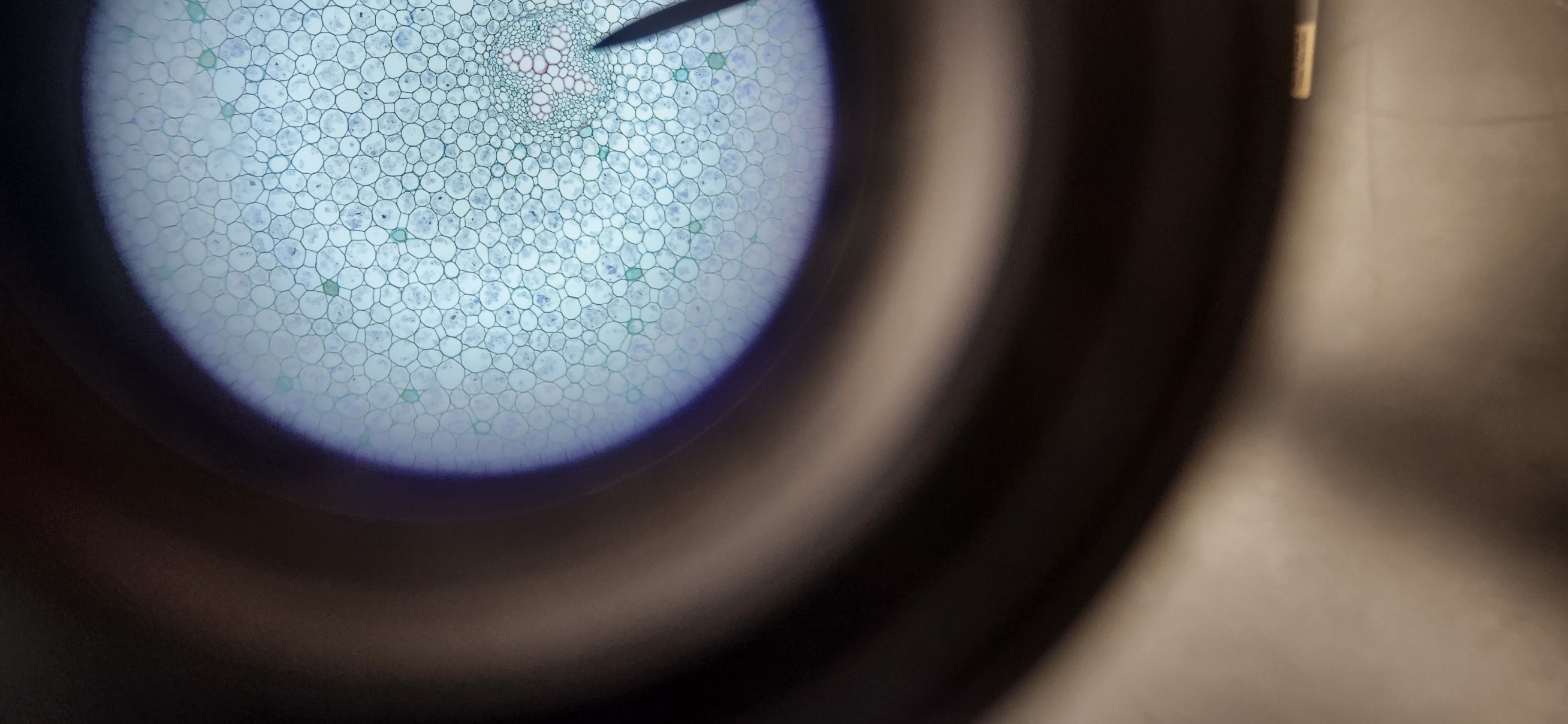 <p>What is the phylum and genus of organism?</p>