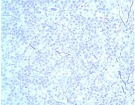 <p>reticular tissue</p>