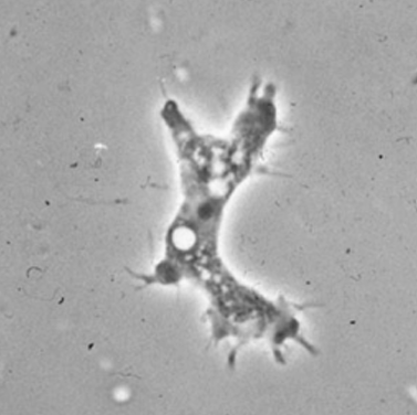 <ol><li><p>Acanthamoeba spp.</p></li><li><p>Trophozoite</p></li><li><p>Acanthamoeba Keratitis (AK), Granulomatous Amebic Encephalitis (GAE)</p></li><li><p>Acanthopodia (thorn-like projections)</p></li><li><p>Eye, Nasal Passages, Broken skin</p></li><li><p>Legionella spp., mycobacteria, E. coli</p></li></ol><p></p>