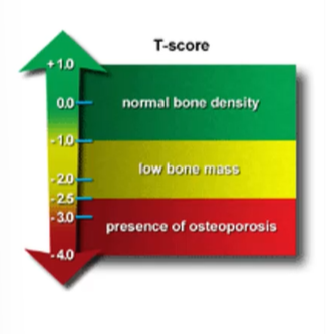 <p>Diagnostics for osteoporosis</p>