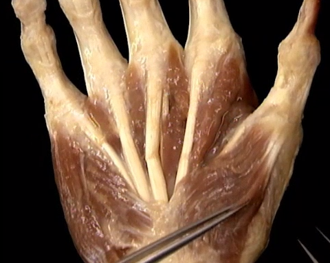 <p>Diep, Handpalm</p>