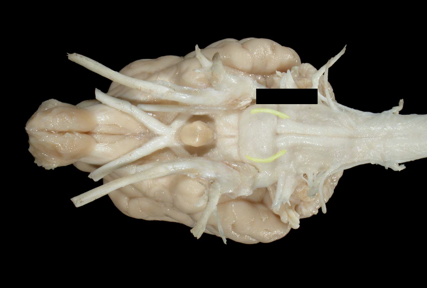 <p>what nerve is this </p>