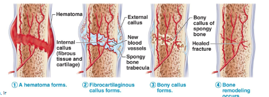 <p>response to mechanical stresses, fragments removed by osteoclasts, osteoblasts lay down spongy bone and then converted to compact </p>