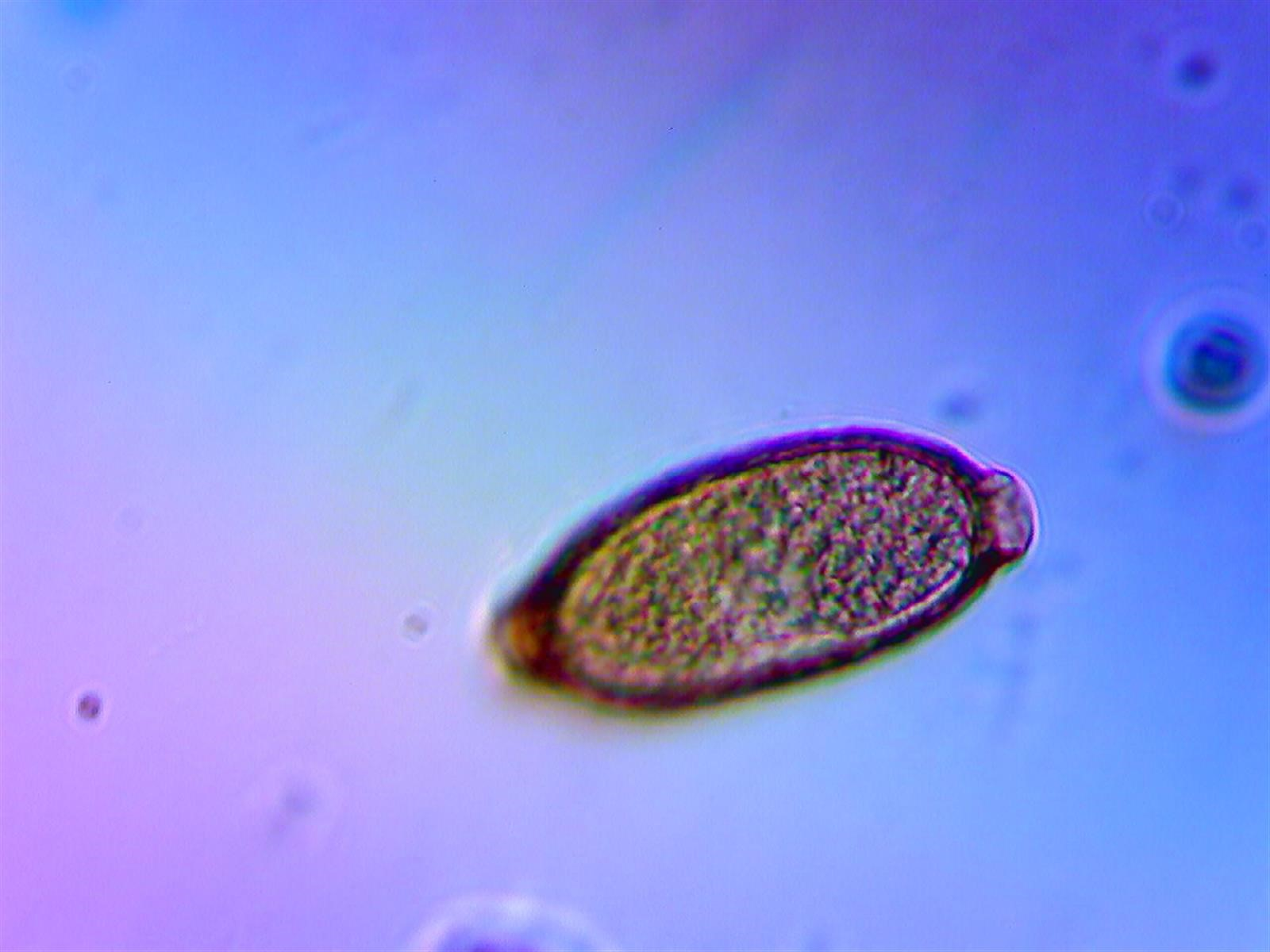 <ul><li><p>Threadworms </p></li><li><p>Treated with fenbendazole and/or ivermectin </p></li><li><p>Smooth, oval shell with plugs on each end </p></li></ul><p></p>