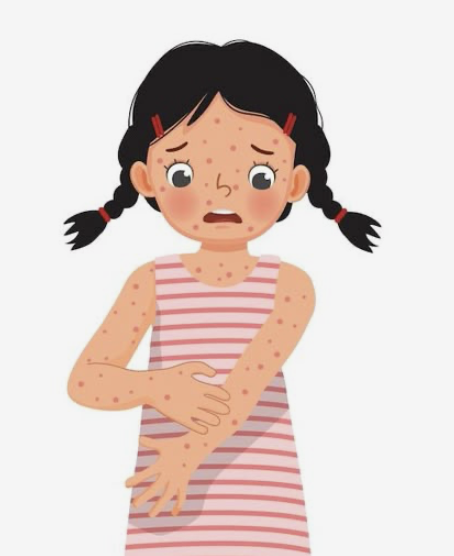 <p><span>stress-related rash</span></p>