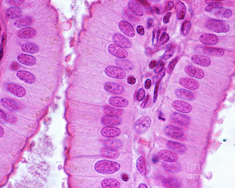 <p>function: absorption; secretion of mucus, enzymes, and other substances; ciliated type propels mucus (or reproductive cells) by ciliary action</p><p>location: conciliated type lines most of the digestive tract (stomach to rectum), gallbladder, and excretory ducts of some glands; cilated variety lines small bronchi uterine tubes, and some regions of the uterus</p>