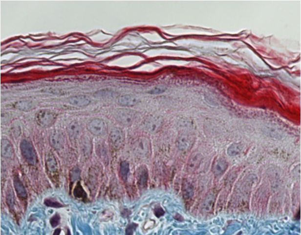 <p><span style="font-family: "Calibri Light";">Is this stratified squamous epithelium keratinized or non-keratinized?</span></p>