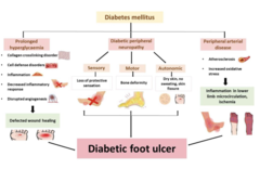 <p>What is the MOST common type of neuropathic ulcer?</p>