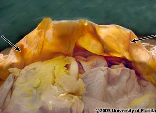 <p>what fold(s) of the peritoneum located on the inner surface of the anterior abdominal wall is indictaed in the image?</p>