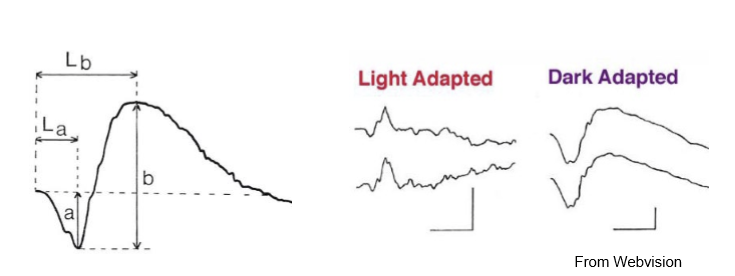 <p>Photopic ERG uses light‑adapted conditions, where rods are minimally active.<br>→ Primarily measures cone system responses, including cone‑driven bipolar cell activity.<br>Used for assessing cone dystrophies, macular disease, and photopic pathway dysfunction.</p>