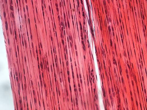 <p>tightly bound</p><p>-protein packing</p><p>-allow movement of white blood cells</p>