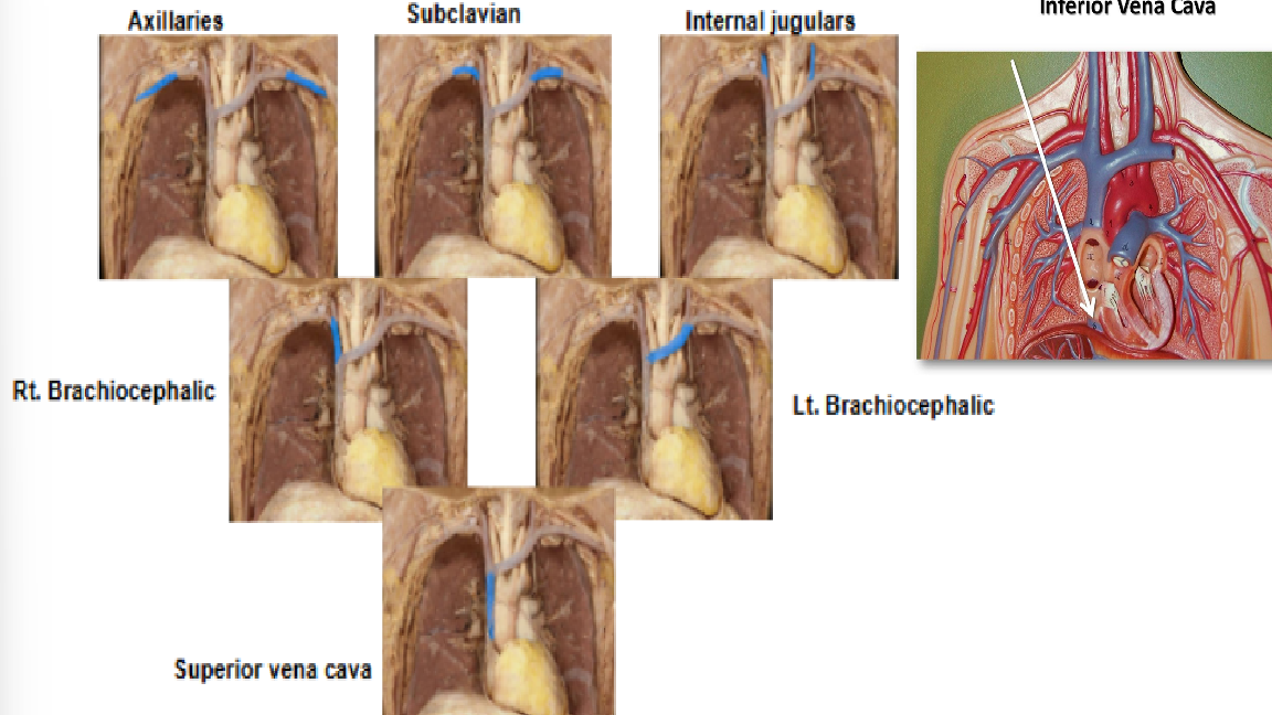 <p>Veins from the head and upper torso drain into the superior vena cava.</p><p>Veins from the lower body drain into the inferior vena cava.</p><p>The vena cavae empty into the right atrium.</p><p>Brachiocephalic veins merge to form the superior vena cava.</p>